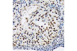 Immunohistochemistry of paraffin-embedded rat ovary using SF3B1 Rabbit mAb (ABIN7270542) at dilution of 1:100 (40x lens).