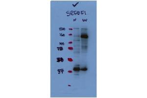 WB Suggested Antibody Titration:  1:1,000   Positive Control:  HepG2 (SREBF1 antibody  (N-Term))