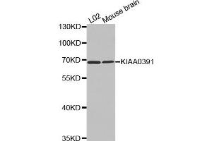 Western Blotting (WB) image for anti-KIAA0391 (KIAA0391) antibody (ABIN1875480)