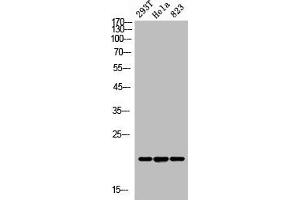 Western Blot analysis of 293T Hela 823 cells using ANG I Polyclonal Antibody (ANG antibody  (N-Term))