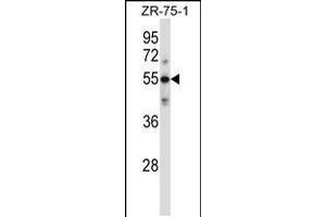 Western blot analysis in ZR-75-1 cell line lysates (35ug/lane). (C9 antibody  (AA 191-220))