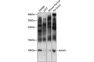 Western blot analysis of extracts of various cell lines, using B antibody (ABIN7265827) at 1:3000 dilution. (BANF1 antibody  (AA 1-89))