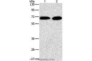 Western blot analysis of Jurkat and NIH/3T3 cell, using PRKCA Polyclonal Antibody at dilution of 1:500 (PKC alpha antibody)