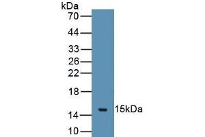 Detection of Recombinant CHRM3, Human using Polyclonal Antibody to Cholinergic Receptor, Muscarinic 3 (CHRM3) (CHRM3 antibody  (AA 1-104))