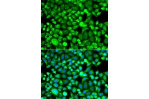 Immunofluorescence analysis of A549 cells using PSMB8 antibody. (PSMB8 antibody  (AA 163-272))