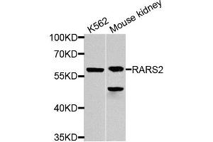 Western blot analysis of extracts of K562 and mouse kidney cells, using RARS2 antibody. (RARS2 antibody)