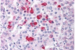 Pancreas (BACE1 antibody  (Internal Region))