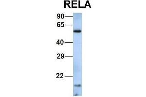 Western Blotting (WB) image for anti-Nuclear Factor-kB p65 (NFkBP65) (Middle Region) antibody (ABIN2779331)