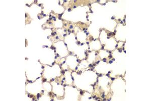 Immunohistochemistry of paraffin-embedded mouse lung using CXXC1 antibody. (CXXC1 antibody)