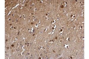 IHC-P Image DCK antibody detects DCK protein at nucleus on mouse hind brain by immunohistochemical analysis. (DCK antibody)