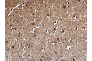 IHC-P Image DCK antibody detects DCK protein at nucleus on mouse hind brain by immunohistochemical analysis.