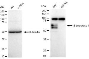 Western blotting analysis using Beta-Secretase 1 antibody (ABIN7797765).