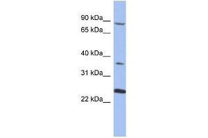 WB Suggested Anti-MPP3  Antibody Titration: 0. (MPP3 antibody  (N-Term))