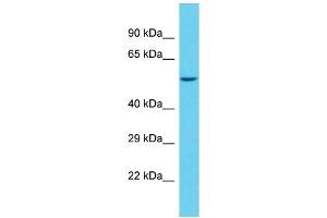 Host: Rabbit Target Name: SAMD1 Sample Type: NCI-H226 Whole Cell lysates Antibody Dilution: 1. (SAMD1 antibody  (C-Term))