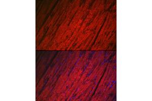 Immunofluorescence analysis of rat heart using HSPB8/HSP22 Rabbit pAb (ABIN3016166, ABIN3016167, ABIN3016168 and ABIN6219596) at dilution of 1:100 (40x lens). (HSPB8 antibody  (AA 1-196))