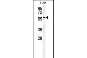 GALNT4 Antibody (N-term) (ABIN654149 and ABIN2844019) western blot analysis in Hela cell line lysates (35 μg/lane). (GALNT4 antibody  (N-Term))