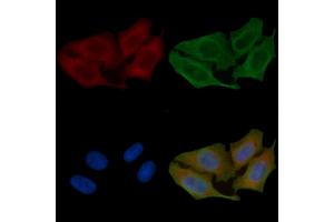 ABIN6261751 and ABIN6266842 staining Hela cells(45 min of heat-shock) by IF/ICC.
