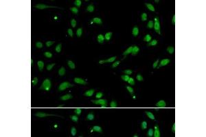 Immunofluorescence analysis of A549 cells using ANP32A Polyclonal Antibody (PHAP1 antibody)
