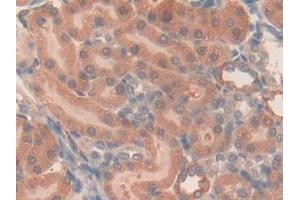 Immunohistochemistry (IHC) image for anti-Oxidized Low Density Lipoprotein (Lectin-Like) Receptor 1 (OLR1) (AA 51-314) antibody (ABIN7434218)