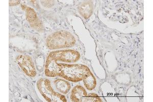 Immunoperoxidase of monoclonal antibody to SERPINA3 on formalin-fixed paraffin-embedded human kidney.