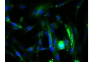 Image provided by One World Lab validation program. (Endoglin antibody  (AA 58-110))