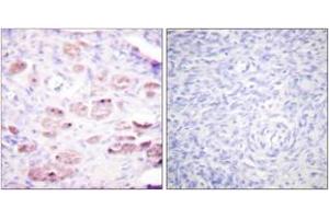Immunohistochemistry analysis of paraffin-embedded human ovary, using Daxx (Phospho-Ser668) Antibody. (DAXX antibody  (pSer668))