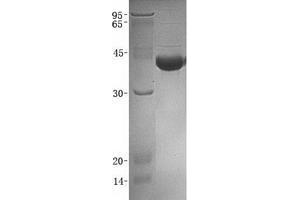 Western Blotting (WB) image for UDP-Gal:betaGlcNAc beta 1,4- Galactosyltransferase, Polypeptide 4 (B4GALT4) (Transcript Variant 2) protein (GST tag,His tag) (ABIN2715126)