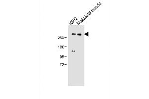 All lanes : Anti-ADTS13 Antibody (Center) at 1:500 dilution Lane 1: K562 whole cell lysate Lane 2: M.