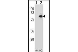 Western blot analysis of GOPC (arrow) using rabbit polyclonal GOPC Antibody (C-term) (ABIN657393 and ABIN2846434). (GOPC antibody  (C-Term))