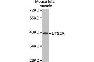 Western Blotting (WB) image for anti-Urotensin 2 Receptor (UTS2R) (AA 280-389) antibody (ABIN3017071) (UTS2R antibody  (AA 280-389))