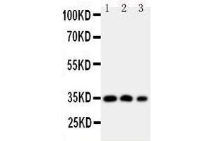 Anti-HOXA4 antibody, Western blotting Lane 1: SW620 Cell Lysate Lane 2: SW620 Cell Lysate Lane 3: PC-12 Cell Nuclear Lysate