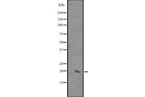 Western blot analysis of SIVA expression in HEK293 cells ,The lane on the left is treated with the antigen-specific peptide. (SIVA1 antibody  (Internal Region))