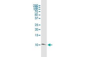 TIMM8B polyclonal antibody (A01). (TIMM8B antibody  (AA 1-83))