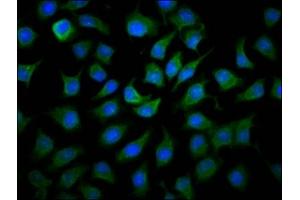 Immunofluorescence staining of A549 cells with ABIN7159627 at 1:166, counter-stained with DAPI. (MCCC1 antibody  (AA 1-200))
