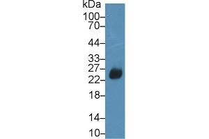 Western Blot; Sample: Rat Spleen lysate; Primary Ab: 2µg/ml Rabbit Anti-Rat SIT1 Antibody Second Ab: 0. (DFFA antibody  (AA 19-262))