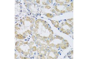Immunohistochemistry of paraffin-embedded human stomach using ATPIF1 antibody at dilution of 1:100 (x40 lens). (ATPase Inhibitory Factor 1 antibody)