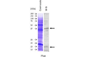 Image no. 1 for anti-Superoxide Dismutase 1, Soluble (SOD1) antibody (ABIN3197496) (SOD1 antibody)