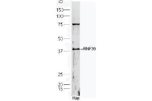 Human Raji cell lysates probed with Rabbit Anti-RNF39 Polyclonal Antibody, Unconjugated  at 1:5000 for 90 min at 37˚C.