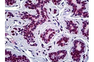 Immunohistochemistry (IHC) image for anti-Stromal Antigen 2 (STAG2) (AA 1130-1232) antibody (ABIN626087)