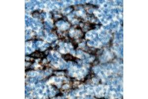 Immunohistochemical analysis of ZAP70 (pY319) staining in human tonsil formalin fixed paraffin embedded tissue section.