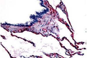 Human Respiratory Epithelium, Bronchial Smooth Muscle, and Alveoli (formalin-fixed, paraffin-embedded) stained with CAV1 antibody ABIN213405 at 3 ug/ml followed by biotinylated goat anti-rabbit IgG secondary antibody ABIN481713, alkaline phosphatase-strepta . (Caveolin-1 antibody  (N-Term))