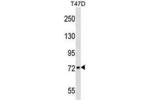 CHADL Antibody (Center) western blot analysis in T47D cell line lysates (35µg/lane). (CHADL antibody  (Middle Region))