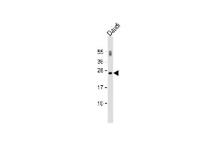 Western Blot at 1:500 dilution + Daudi whole cell lysate Lysates/proteins at 20 ug per lane. (PTTG1 antibody  (N-Term))