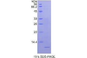 SDS-PAGE analysis of Human Nucleophosmin Protein. (NPM1 Protein)