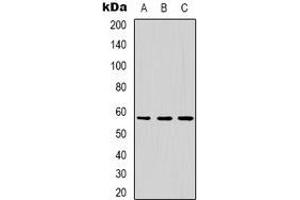 Western blot analysis of Dyskerin expression in MCF7 (A), HepG2 (B), Jurkat (C) whole cell lysates. (DKC1 antibody)