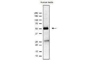 Western Blotting (WB) image for anti-Izumo Sperm-Egg Fusion 1 (IZUMO1) antibody (ABIN2452040)