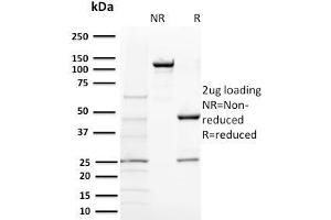 SDS-PAGE Analysis Purified BAP1 Mouse Monoclonal Antibody (BAP1/2431). (BAP1 antibody  (AA 191-326))