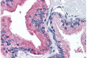 Human Prostate (formalin-fixed, paraffin-embedded) stained with B2M antibody ABIN364376 at 10 ug/ml followed by biotinylated anti-mouse IgG secondary antibody ABIN481714, alkaline phosphatase-streptavidin and chromogen. (beta-2 Microglobulin antibody)
