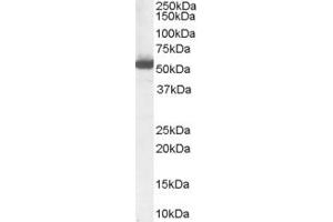 ABIN185587 (1µg/ml) staining of Human Liver Lysate (35µg protein in RIPA buffer). (ALDH1A1 antibody  (Internal Region))