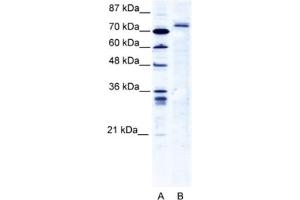 Western Blotting (WB) image for anti-Tripartite Motif Containing 9 (TRIM9) antibody (ABIN2461066) (TRIM9 antibody)